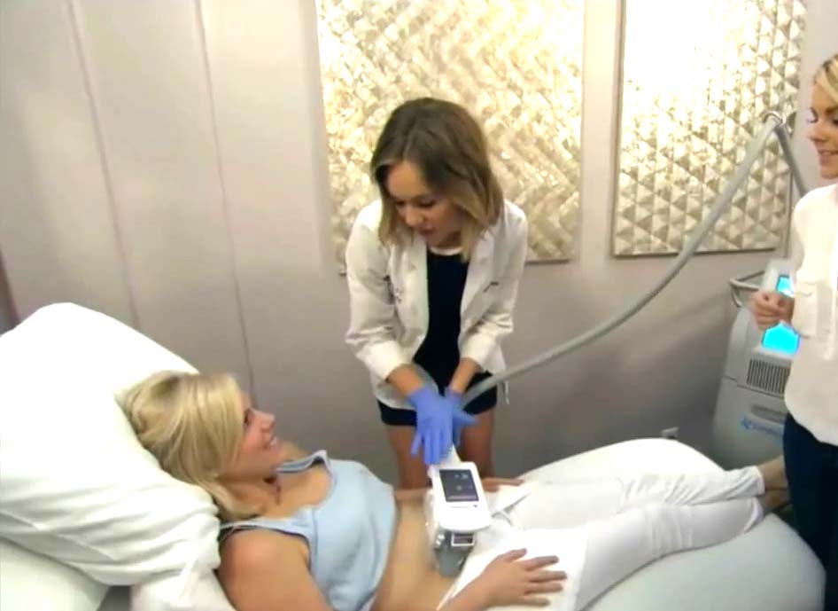 procedimento de coolsculpting